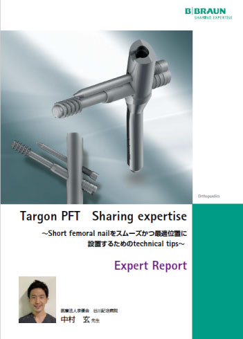 Targon PFT Sharing expertise ～Short femoral nailをスムーズかつ最適位置に 設置するためのtechnical tips～